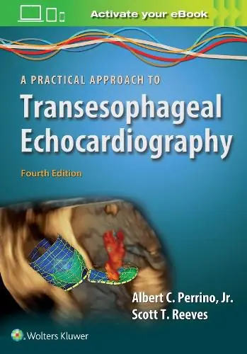 A Practical Approach to Transesophageal Echocardiography - Albert C. Perrino,Scott T. Reeves Price Cut